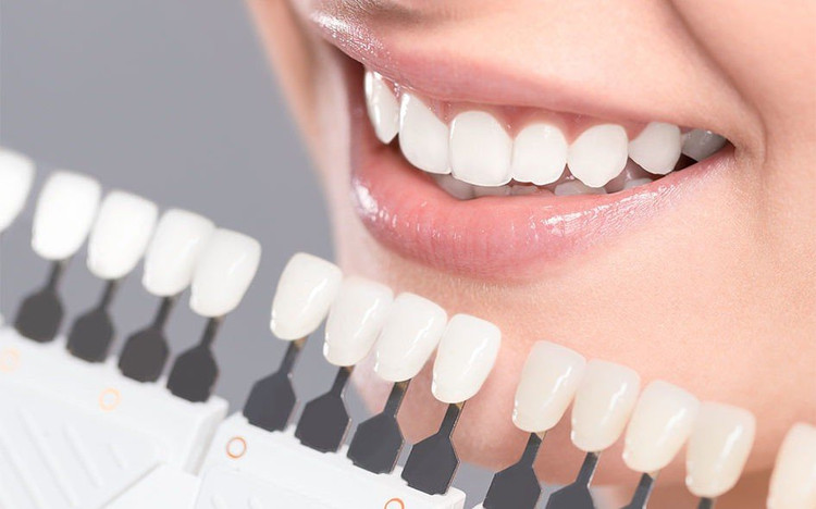 Tokuyama Dental Composite – سرنگ استایلیت سیگما کوئیک یا آستریا با لوگوی Tokuyama ژاپن، چیدمان جعبه و شیدها (A1, A2…) روی زمینه سفید | panamal.ir