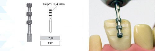 فرز سر موج دار دیاتیز کد 834 RD | فرز پرداخت و پالیش دندانپزشکی DiatitZ | panamal.ir