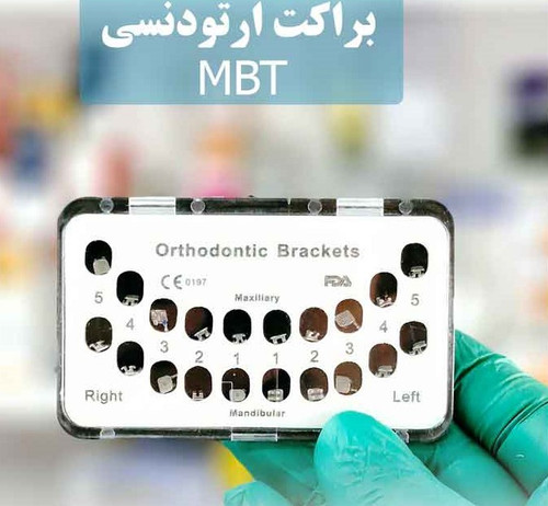 براکت MBT با طراحی حرفهای برای درمان ارتودنسی