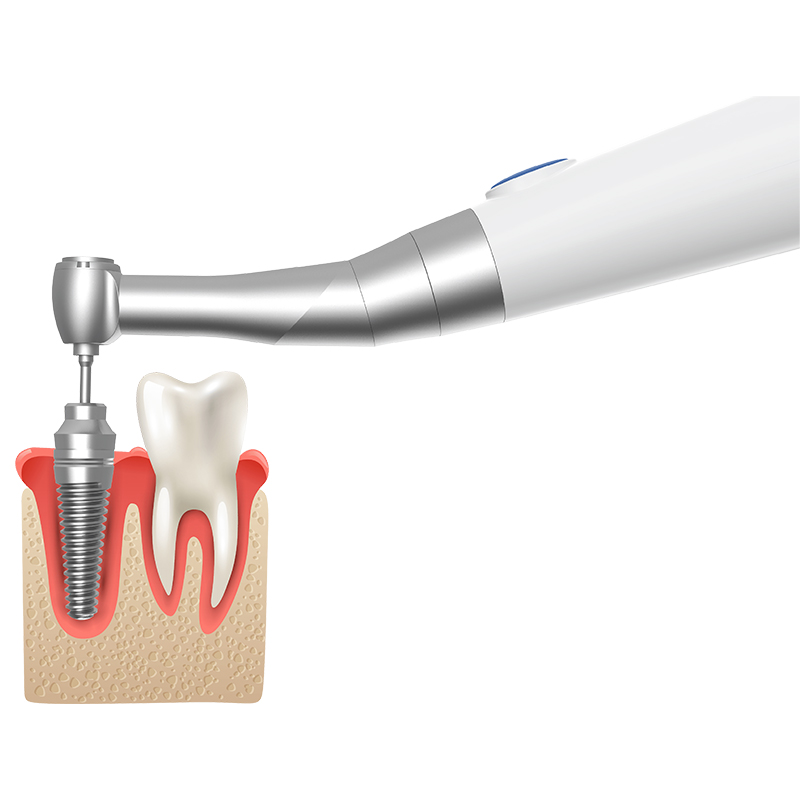 panamal.ir موتور هوشمند گشتاور ایمپلنت بی‌سیم مدل Motor X Smart با ست ۱۶ سری پیچ‌گوشتی دندانپزشکی