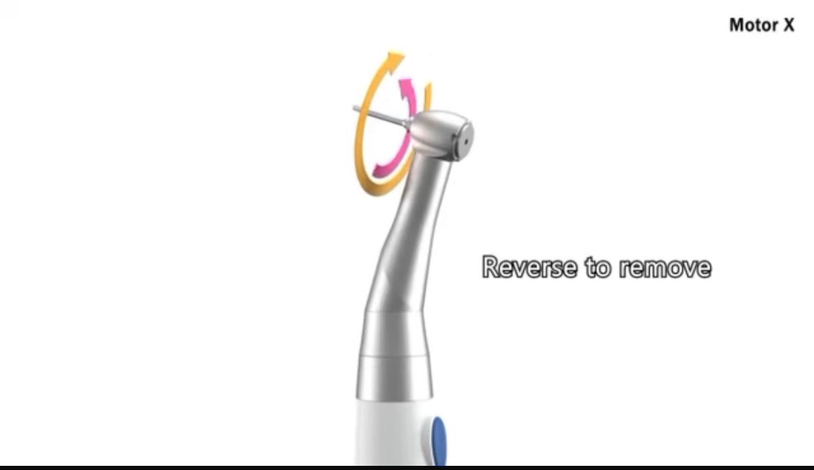 panamal.irاستفاده از موتور گشتاور ایمپلنت Motor X Smart در فرآیند کاشت ایمپلنت دندان