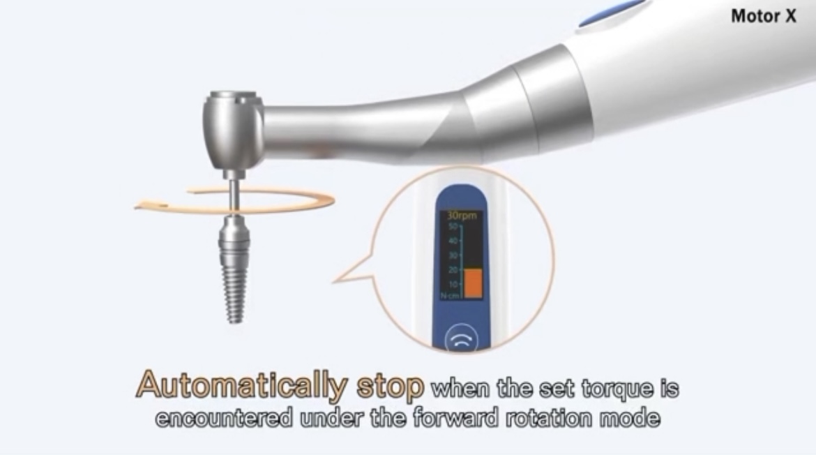 panamal.ir موتور هوشمند گشتاور ایمپلنت بی‌سیم مدل Motor X Smart با ست ۱۶ سری پیچ‌گوشتی دندانپزشکی