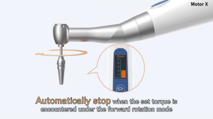panamal.ir موتور هوشمند گشتاور ایمپلنت بیسیم مدل Motor X Smart با ست ۱۶ سری پیچگوشتی دندانپزشکی