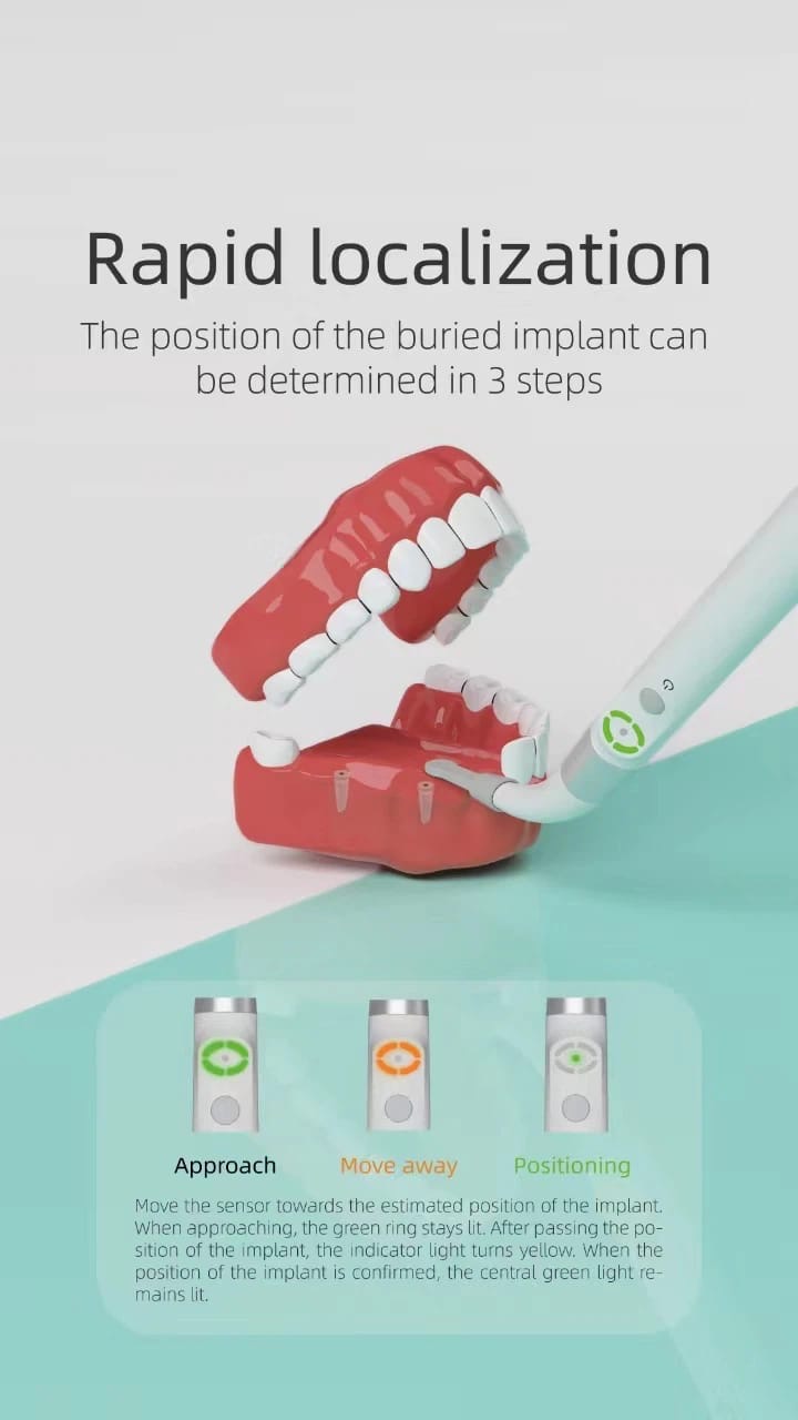 implant locator