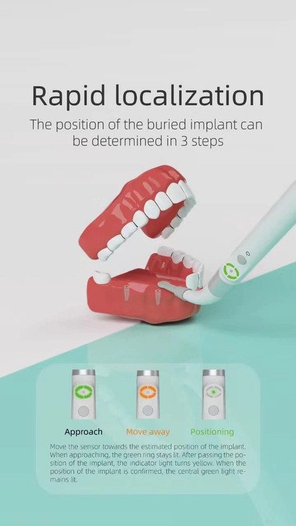 implant locator