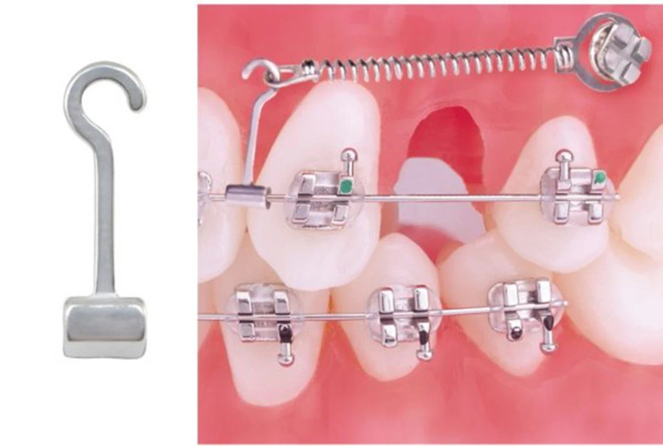 CRIMPABLE HOOK در panamal.ir